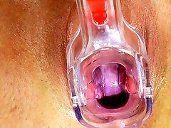 Enjoy chubby matures full gyno exam