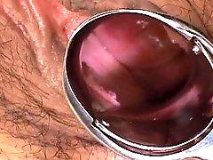 Gyno exam cum-hole opened wide oriental porn