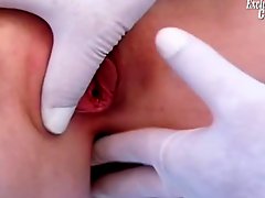 Gloved fingers of doctor inside the redhead